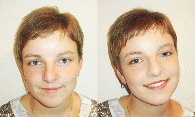 Vorher-Nachher Kosmetikstudio Radeberg